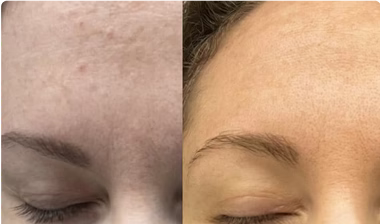 Catherine, 49
